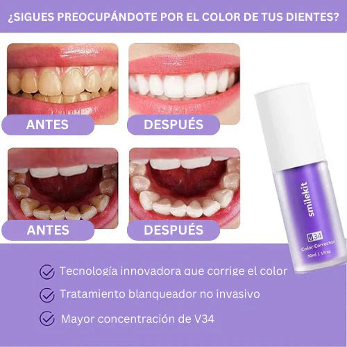 SMILE KIT F - Blanqueador Dental V32