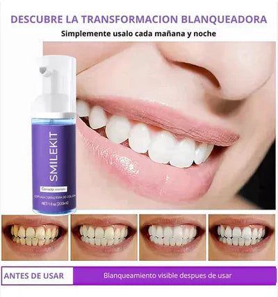 SMILE KIT F - Blanqueador Dental V32