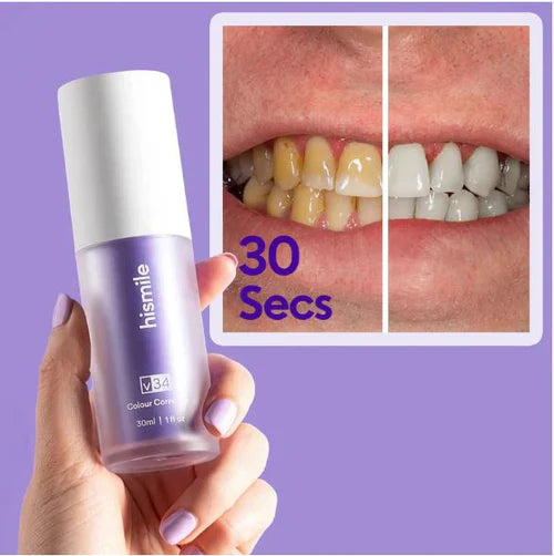 SMILE KIT F - Blanqueador Dental V32